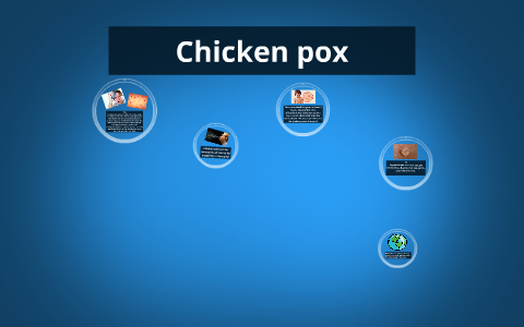 Chicken pox by Brandon Young on Prezi
