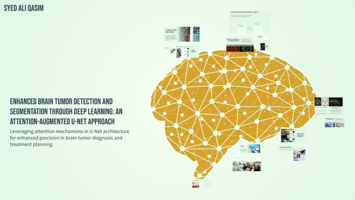 Enhanced Brain Tumor Detection and Segmentation Through Deep Learning ...