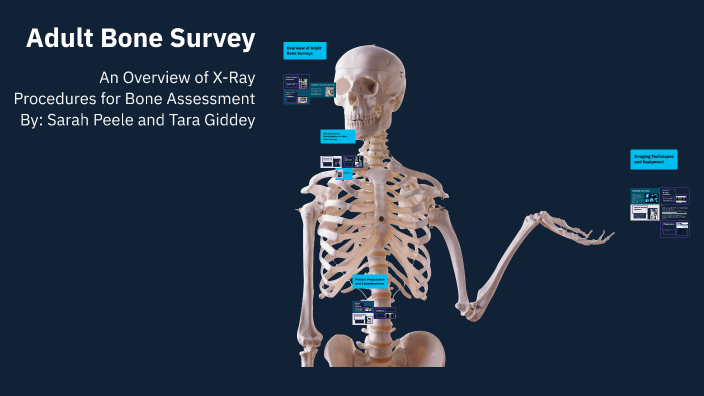 Adult Bone Survey by Tara Giddey on Prezi