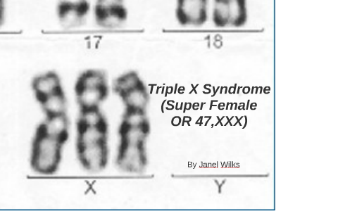 triple x syndrome karyotype