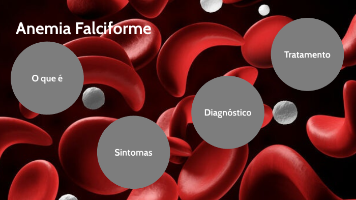 Anemia Falciforme By Isah Felix On Prezi 4030