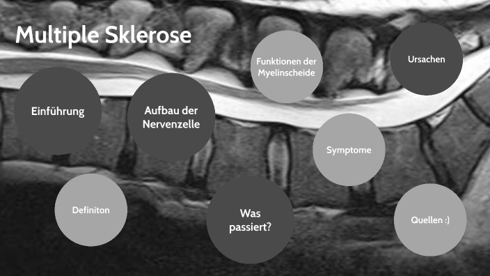 Multiple Sklerose By Amilia Freund On Prezi