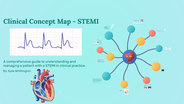 Clinical Concept Map for STEMI Patient by Kylie Whittington on Prezi