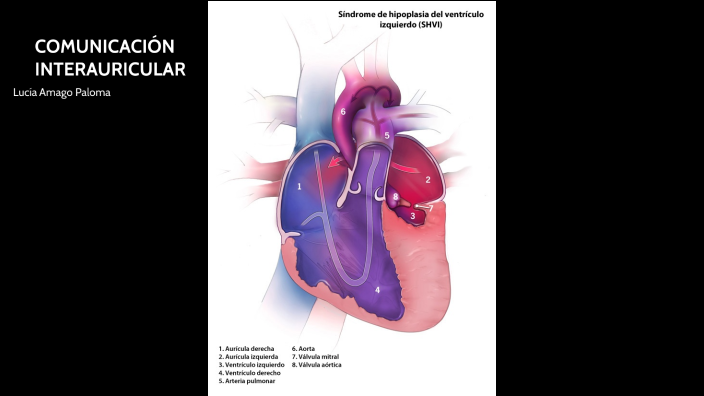 COMUNICACIÓN INTERAURICULAR by Luuli Amago Paloma on Prezi