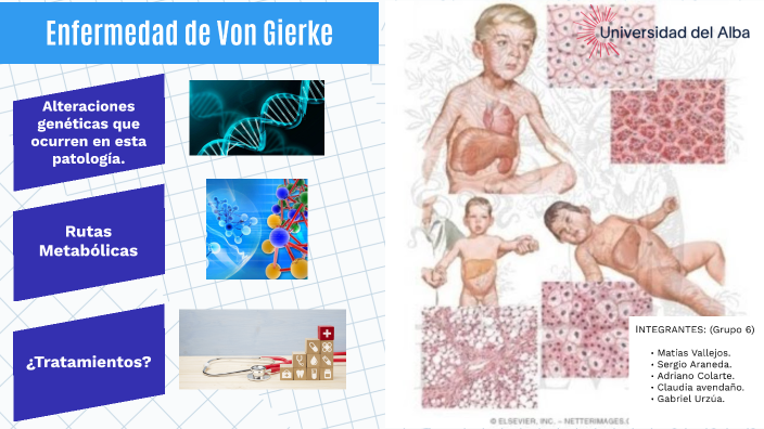 Enfermedad de Von Gierke by GABRIEL ANDRES URZUA GARCIA on Prezi