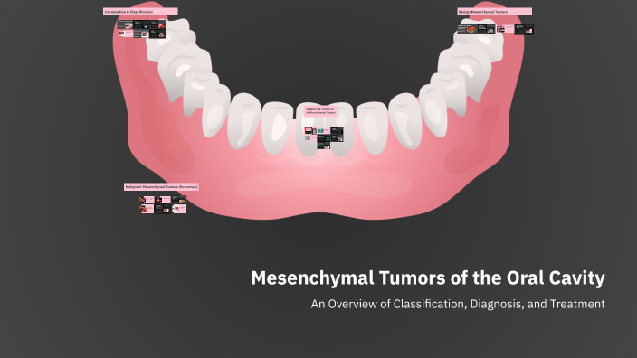 Mesenchymal Tumors of the Oral Cavity by Adel Essa on Prezi