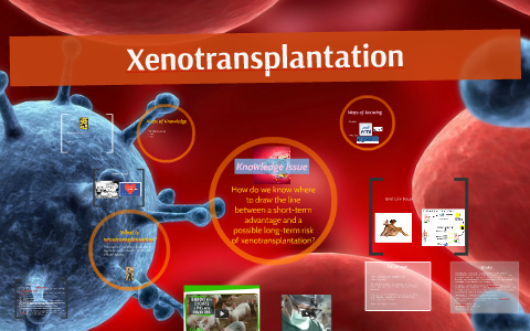 xenotransplantation argumentative essay