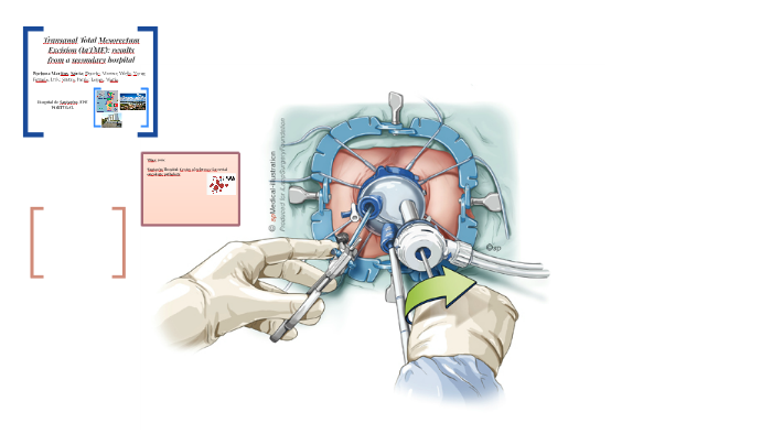 Transanal Total Mesorectum Excision taTME Results From A By S nia 