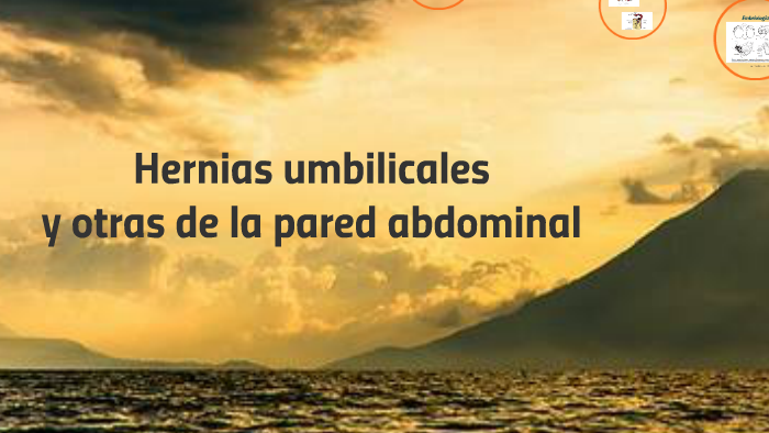 Hernias umbilicales y otras de la pared abdominal by Camilo Tiu on Prezi