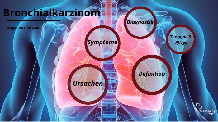 Lungenkarzinom by Ana Figueiredo on Prezi