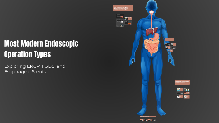 Most Modern Endoscopic Operation Types by Oyatbek Kholmirzaev on Prezi
