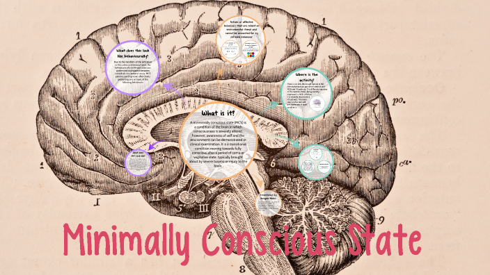 Minimally Conscious State by Anngela Albers on Prezi Next