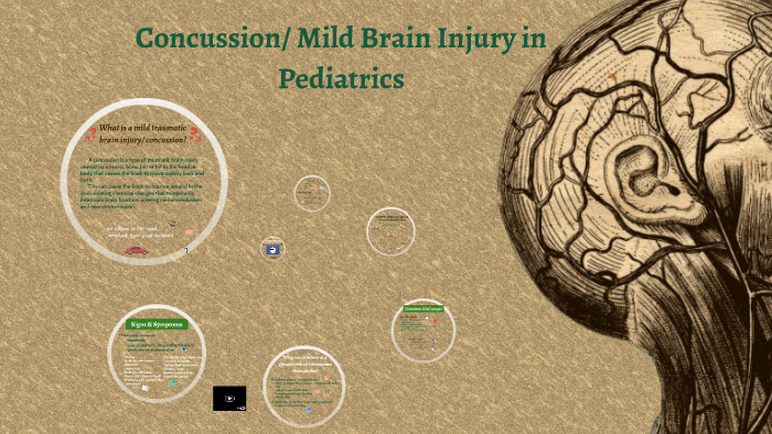 Concussion Mild Brain Injury By On Prezi