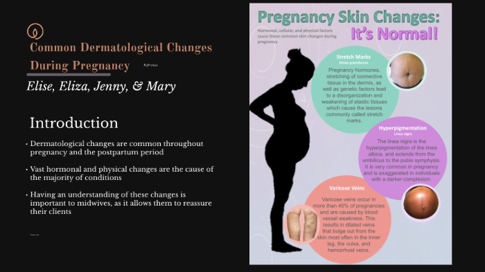 Common Dermatological Changes During Pregnancy By Mary Goodwin On Prezi