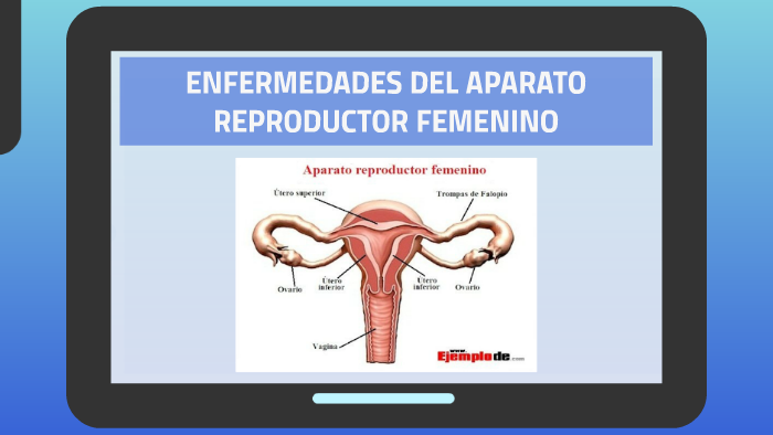 enfermedades causadas por virus en el aparato reproductor femenino