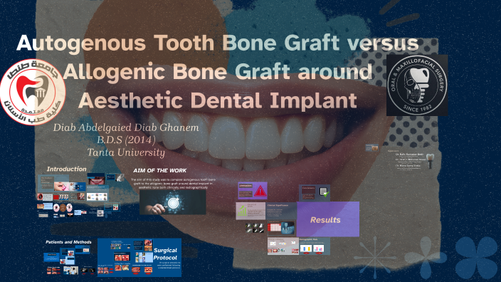 Autogenous Tooth Bone Graft vs Allogenic Bone Graft by ‪Diab Mahmoud ...