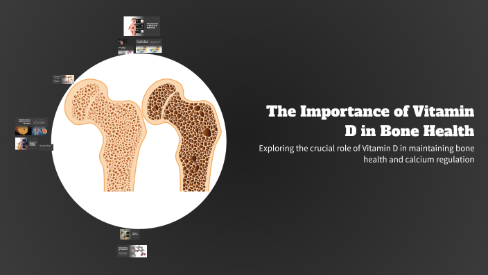 The Importance of Vitamin D in Bone Health by Hazem Farouk on Prezi