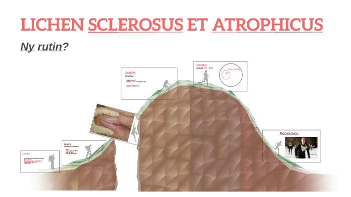 lichen sclerosus et atroficus