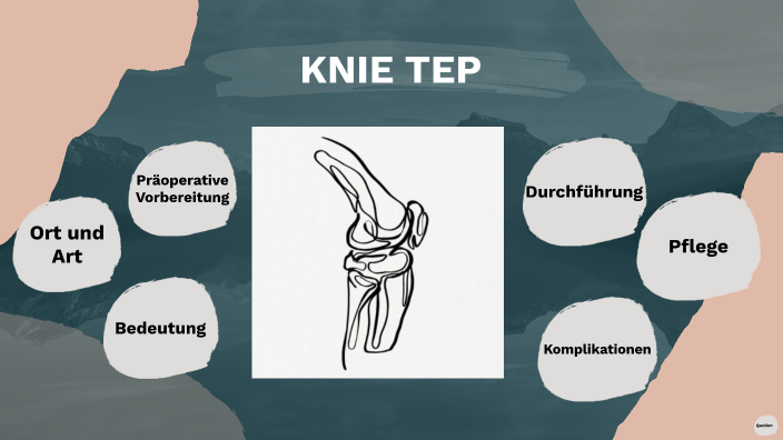 Knie TEP by Alina Marie Kikenberg on Prezi