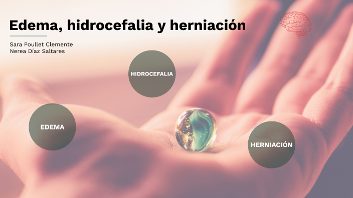 Edema Hidrocefalia Y Herniación By Nerea Diaz On Prezi Next 6286