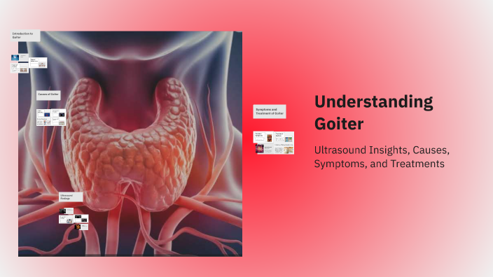 Understanding Goiter by gabby jones on Prezi