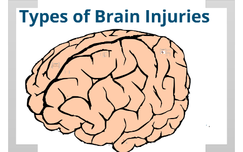 4 Types of Brain Injuries by David Zhu on Prezi