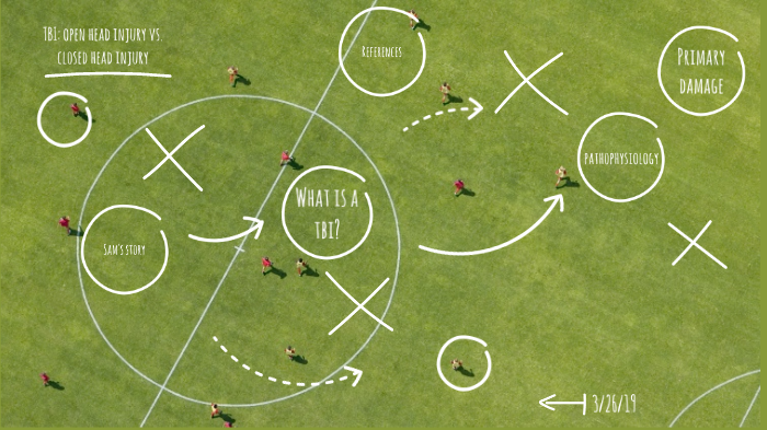 TBI: Open Head Injury vs. Closed Head Injury by Madison Flye on Prezi