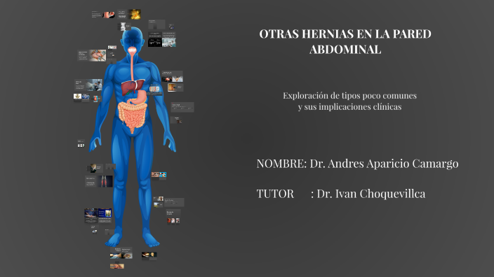 Otras Hernias en la Pared Abdominal by grace villarroel on Prezi