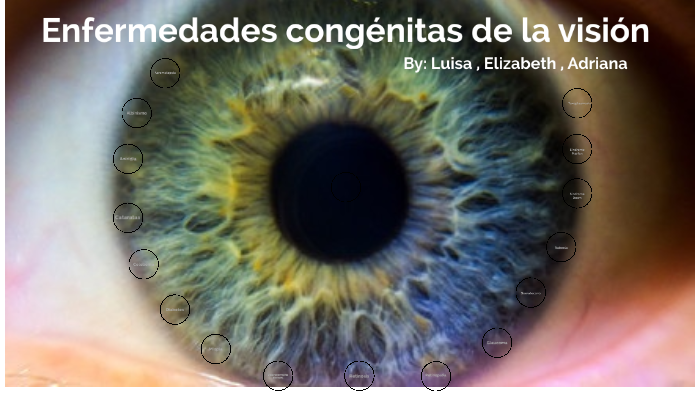 Discapacidad visual - ENFERMEDADES CONGENITAS by Adriana Maria Oquendo ...