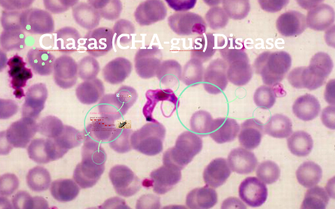 Chagas CHA gus Disease by Sophia Orlando on Prezi