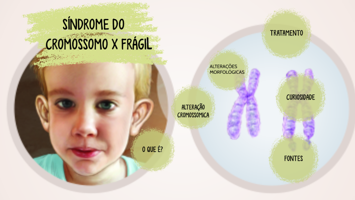 Síndrome do cromossomo x Frágil by Maysa Amaral on Prezi