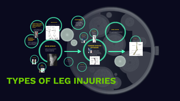 TYPES OF LEG INJURIES by lee zhengwei on Prezi