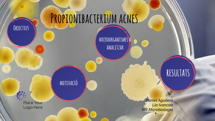 Propionibacterium Acnes By Lia Ivancea