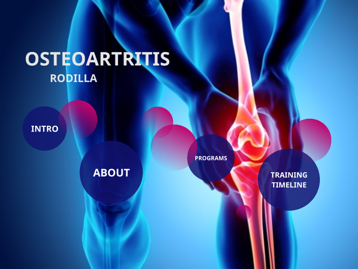 OSTEOARTRITIS EN RODILLA by Brenno Eregipe