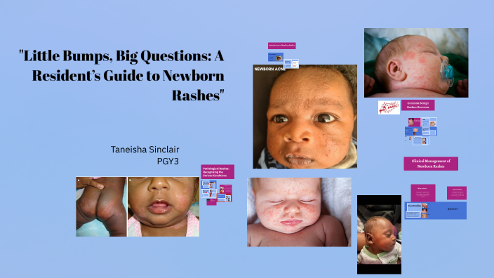 Understanding Newborn Rashes: Identification and Management by Taneisha ...
