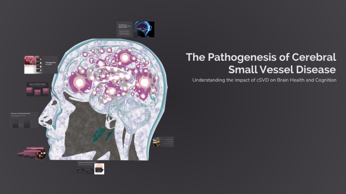 The Pathogenesis of Cerebral Small Vessel Disease by Devin Keasey on Prezi