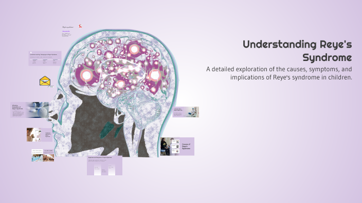 Understanding Reye s Syndrome By Kim Tabarek On Prezi understanding-reye-s-syndrome-by-kim-tabarek-on-prezi