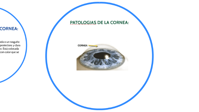 PATOLOGIAS DE LA CORNEA by on Prezi