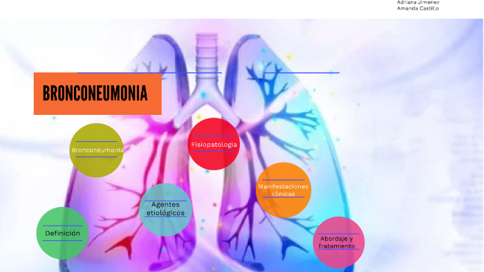 Bronconeumonía Vs Neumonía Lobar