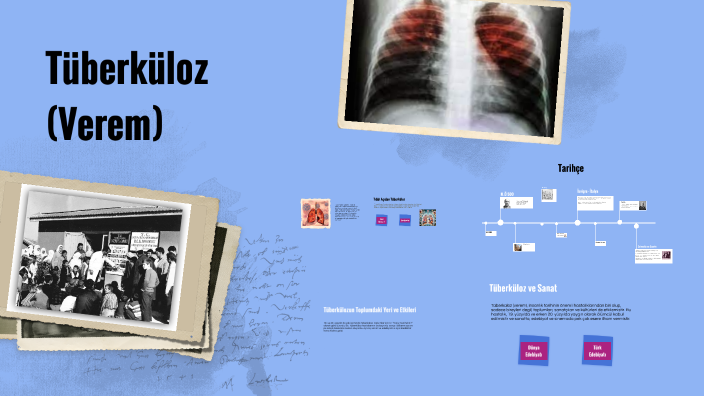 Tüberküloz (Verem) by zeynep yön on Prezi