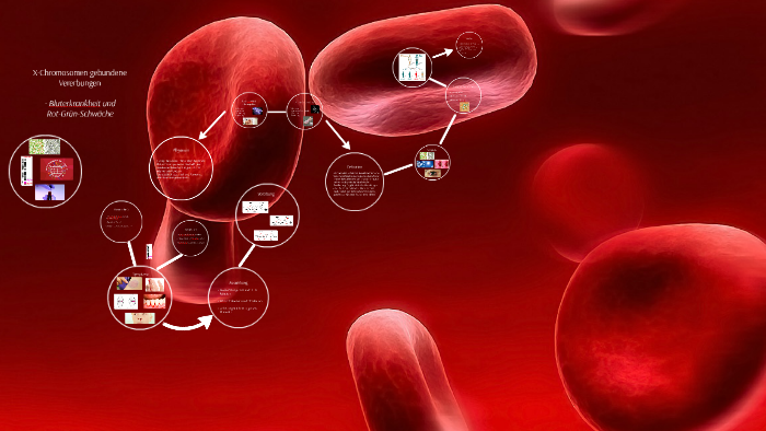 Bluterkrankheit + Rot/Grün- Schwäche By Lourixo Lourixo On Prezi