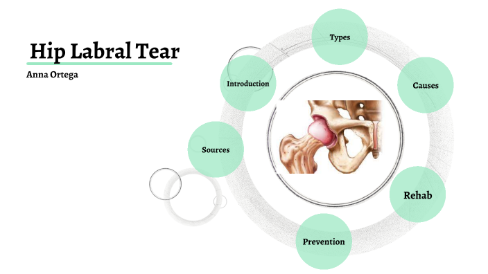 This Labral Tear Hip Test Is Changing How We Treat Hips - 37kmjdn