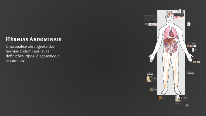 Hérnias Abdominais by karla katarine rodrigues teixeira bastos on Prezi