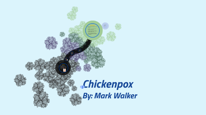 Chickenpox by on Prezi