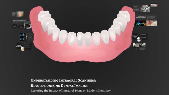 Understanding Intraoral Scanners: Revolutionizing Dental Imaging by ...