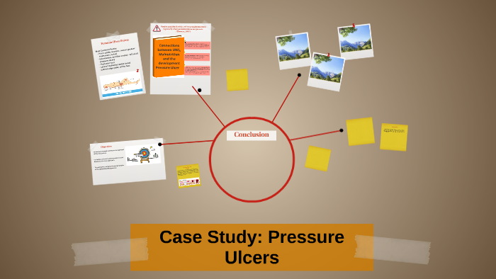 sample case study of pressure ulcer