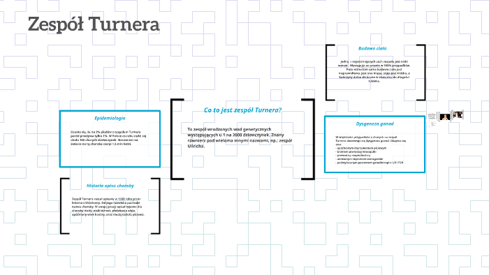 Zespół Turnera by prezentacja bio on Prezi