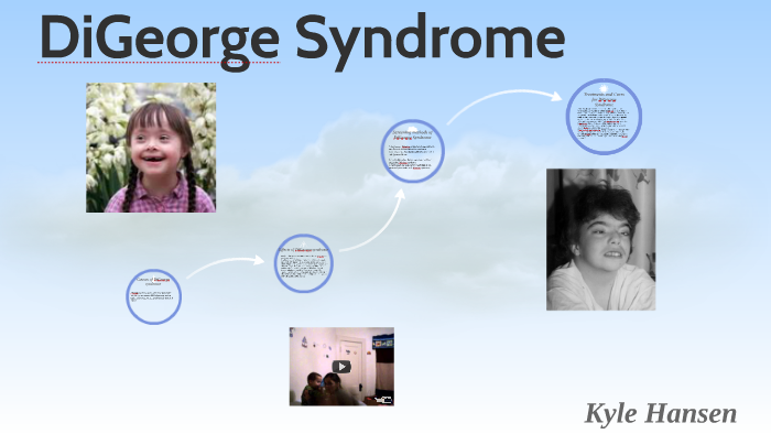 DiGeorge Syndrome By KYLE HANSEN