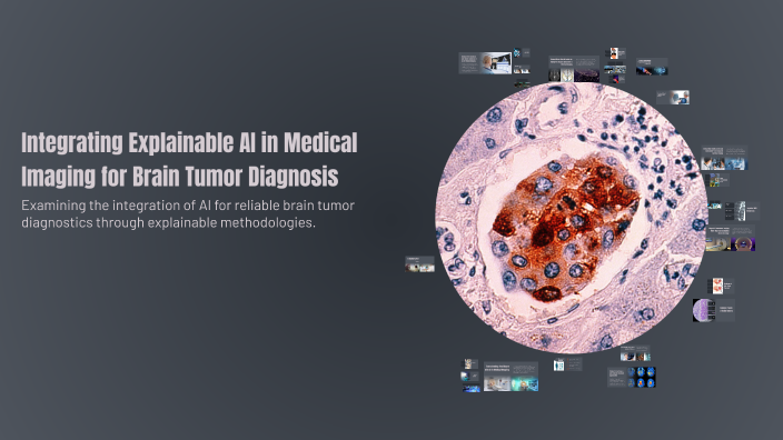 Integrating Explainable AI in Medical Imaging for Brain Tumor Diagnosis ...