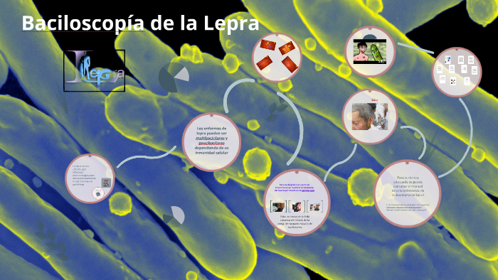 Baciloscopía de la lepra by FRANCISCO JAVIER ARCE MARTINEZ on Prezi Next